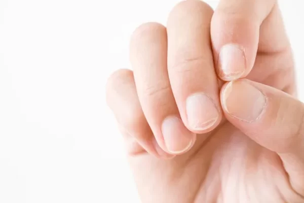 How to cure fungal nails From gel manicure